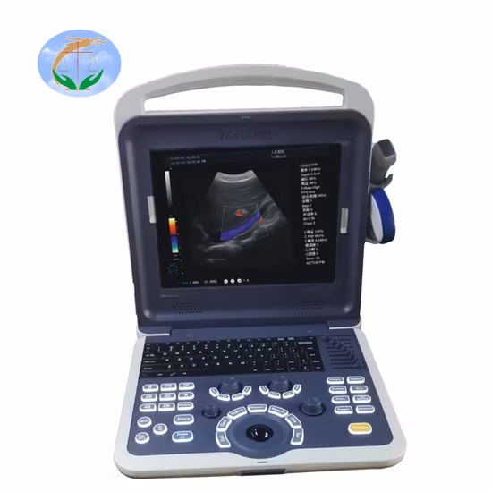 Máquina de ultrassom de diagnóstico Doppler colorido digital portátil de 12 polegadas médica