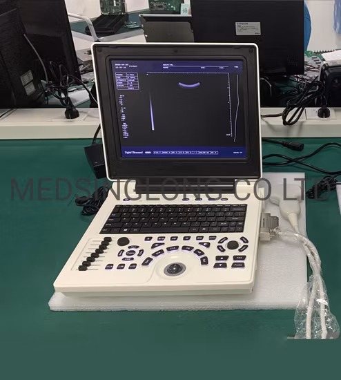 Máquina de ultrassom totalmente digital portátil de 12 polegadas com preço de fábrica Mslpu33A